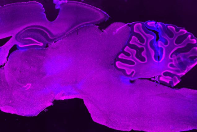 Photo: A cross section of a rat brain that is vibrant purple with blue highlights