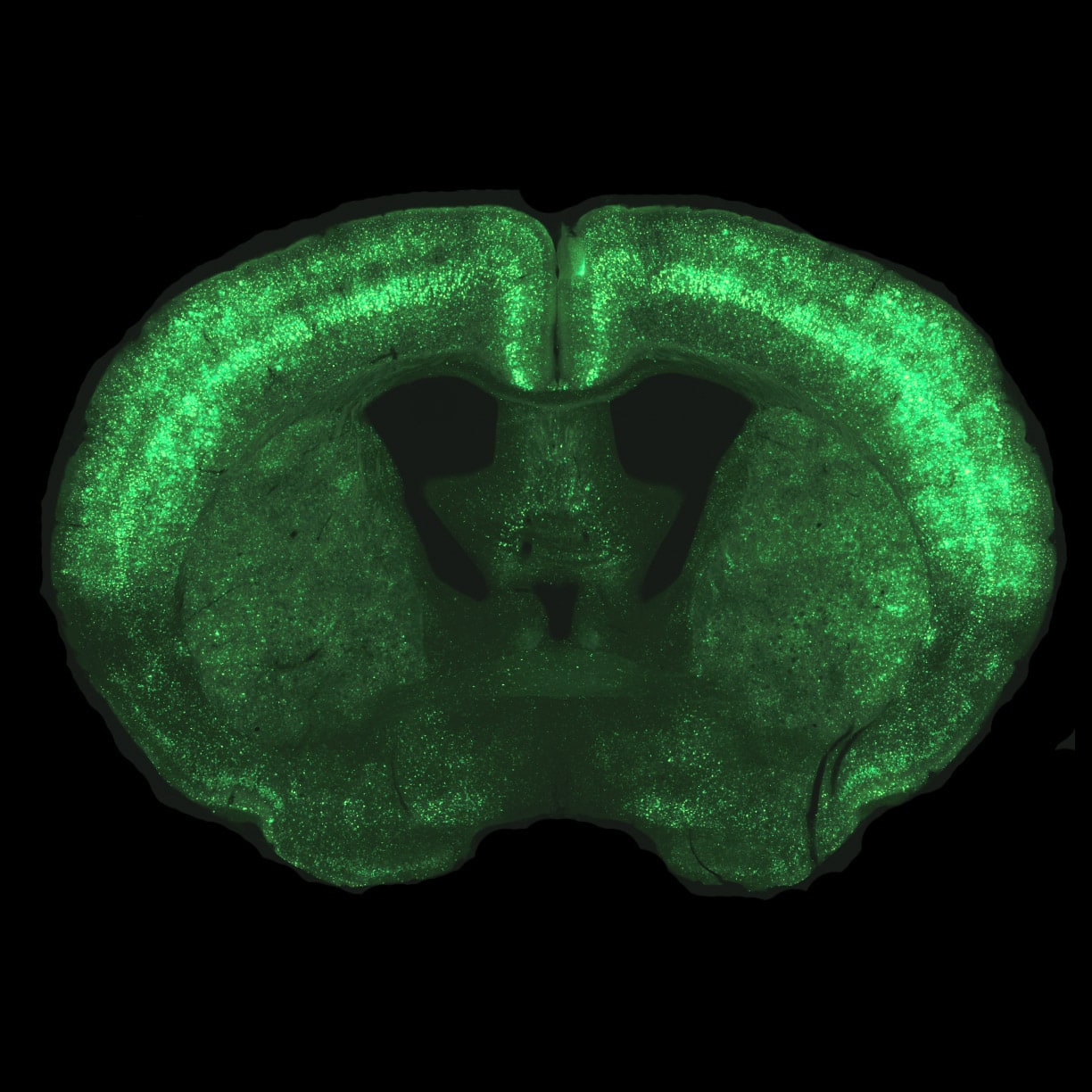 Computational Neuroscience