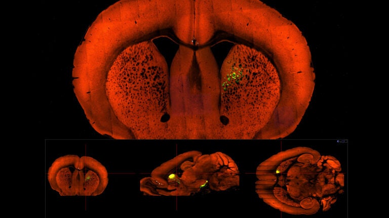 image of mouse brain motivational center