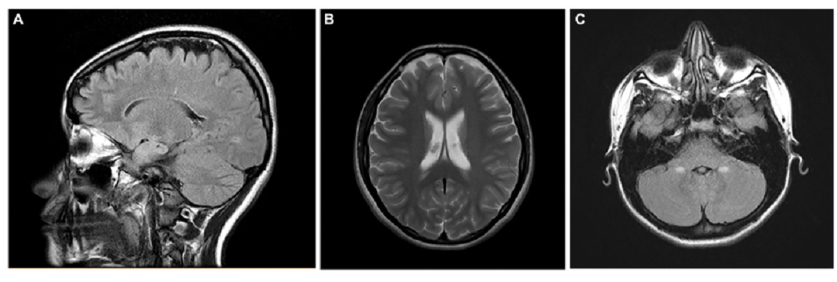 Scans of the brain