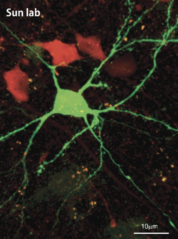 Mechanisms of brain development